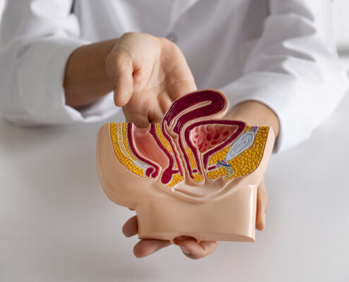 hemorrhoids