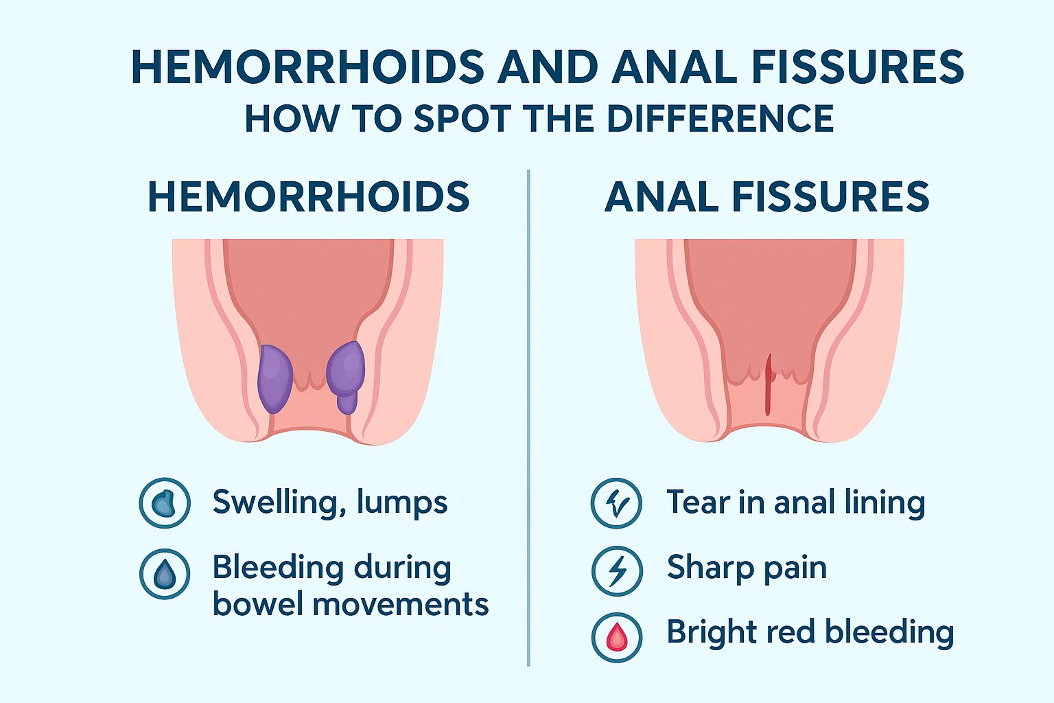 Hemorrhoids and Anal Fissures How to Spot the Difference